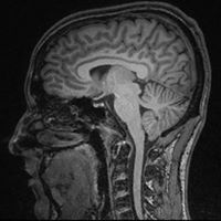 Allen Mcconnell Photo 15