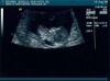Jessica Kearns Photo 45