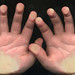 Owen Hand Photo 13
