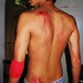Kyle Rash Photo 5
