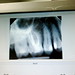 Ray Root Photo 5