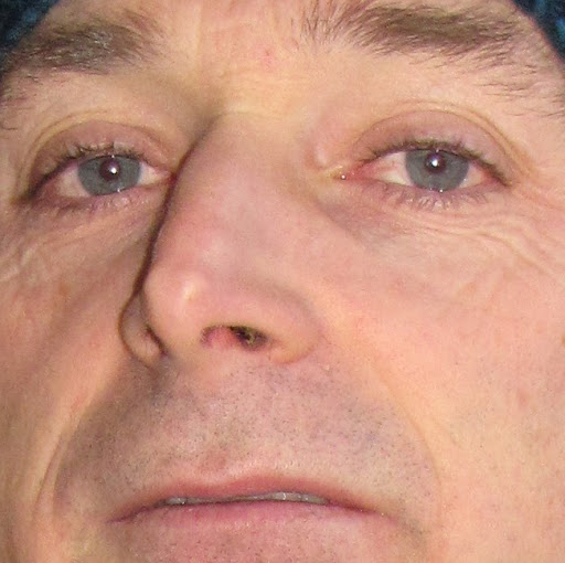 Daniel Keyes Photo 43