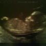 Charlene Beck Photo 11