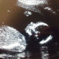 Jessica Potts Photo 10
