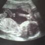 Jodie Harvey Photo 14