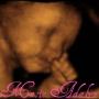Laura Hendricks Photo 29