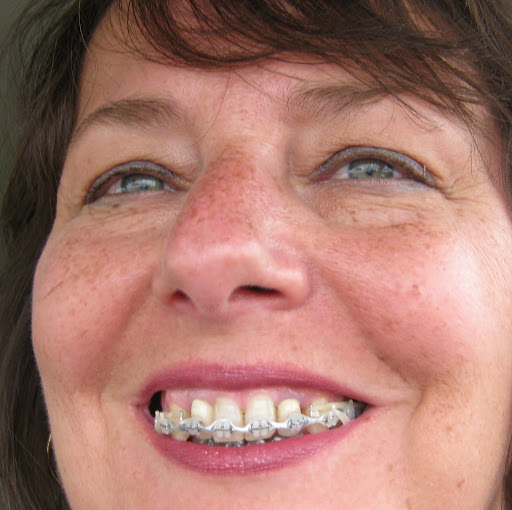 Linda Spencer Photo 21