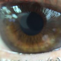 Peter Holtz Photo 20