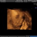 Ethan Charles Photo 18