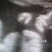 Devin Miller Photo 21