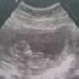 Melissa Baer Photo 11