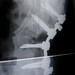 Ray Hurt Photo 10