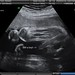 Ethan Charles Photo 19