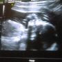 Victoria Austin Photo 12