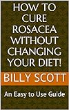 How To Cure Rosacea Without Changing Your Diet!: An Easy To Use Guide