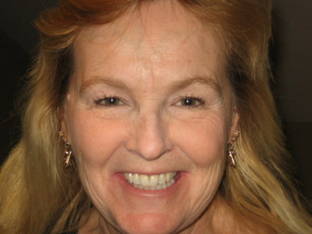 Elizabeth Hunt Photo 25